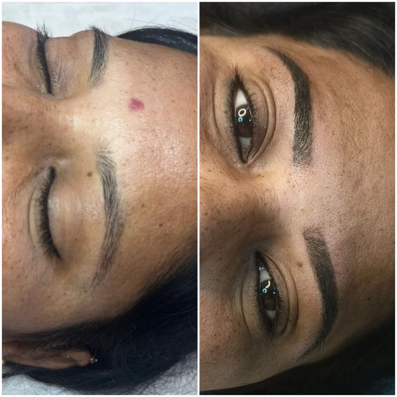 Combination Brows