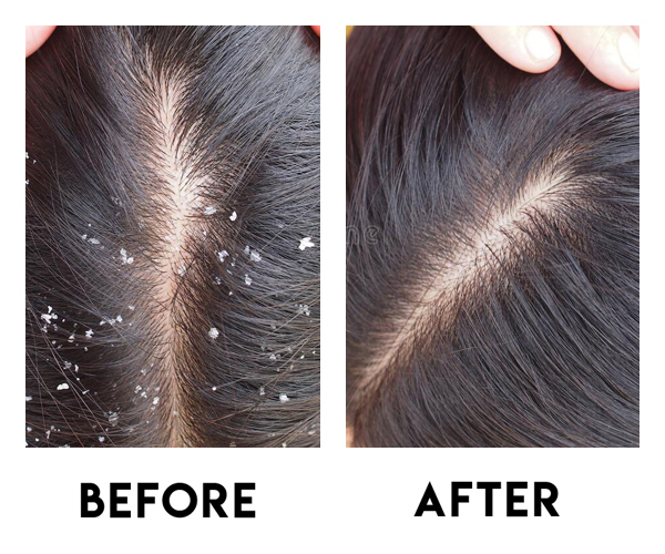 Hair Nourishment