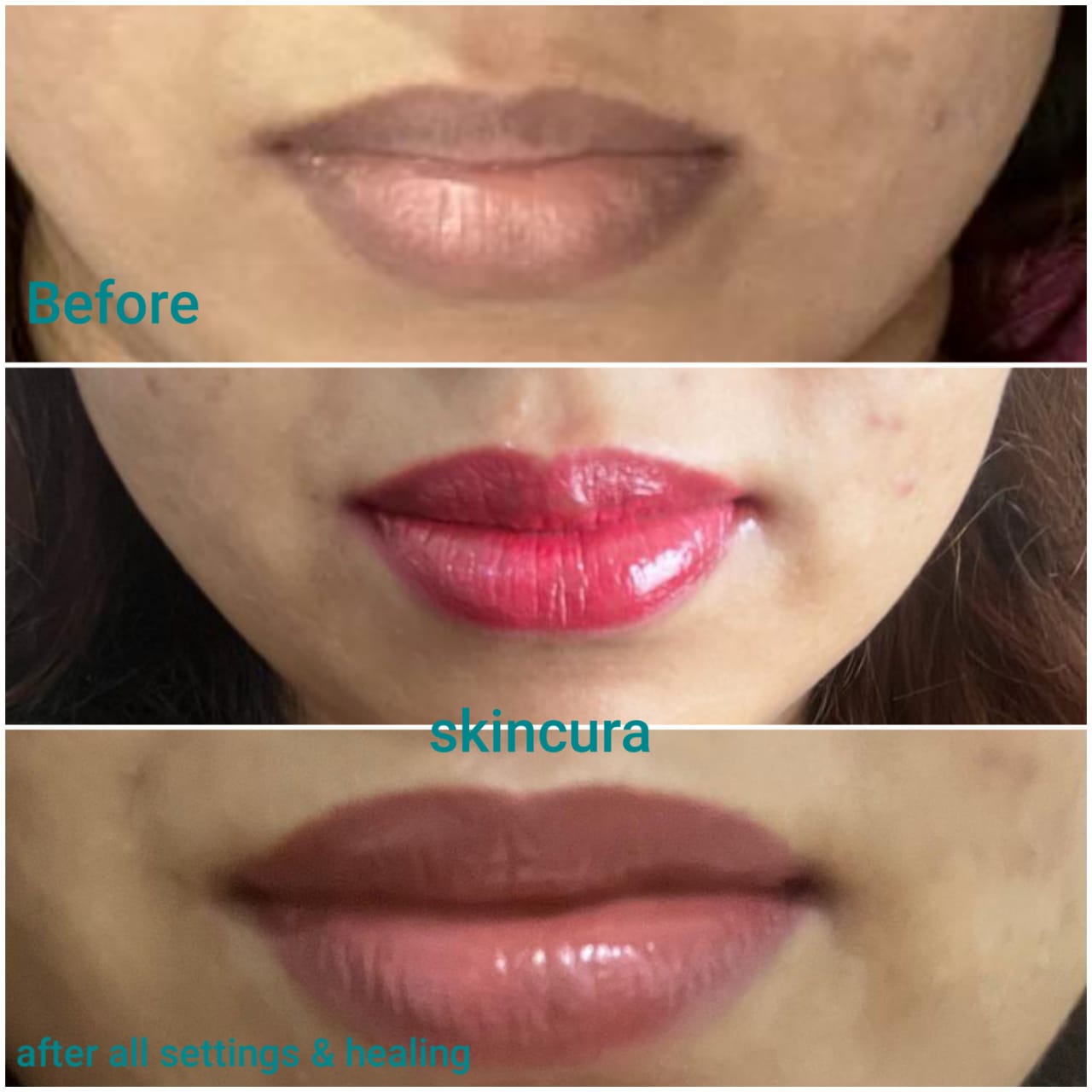 Lip Blushing