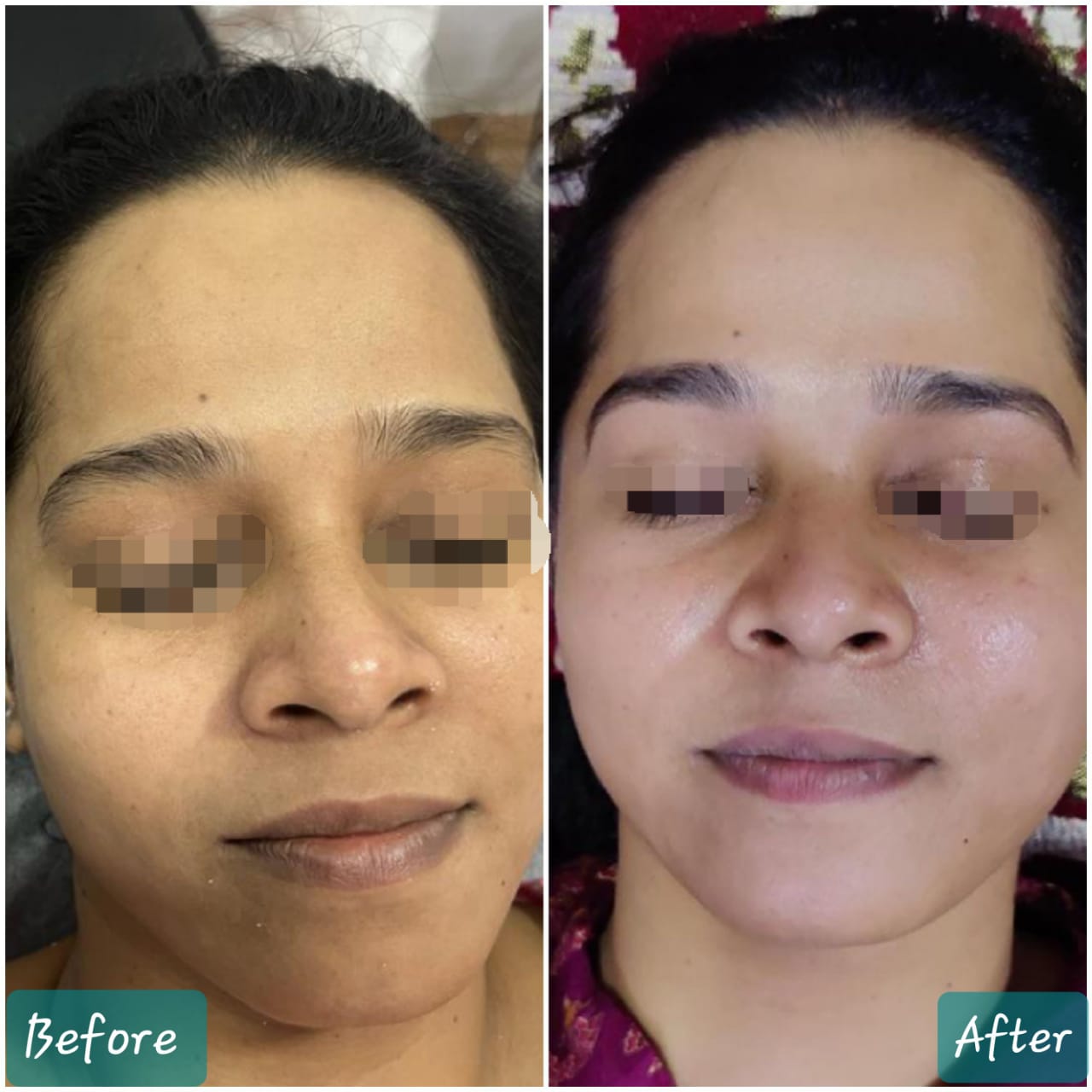 Medifacial